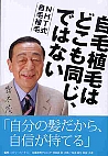 自毛植毛はどこも同じ、ではない